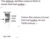 TGFBI Antibody