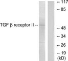 TGFBR2 Antibody - Western blot analysis of lysates from HepG2 (65K) cells, using TGF beta Receptor II Antibody. The lane on the right is blocked with the synthesized peptide.