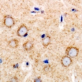 TGFBR2 Antibody - Immunohistochemical analysis of TGFBR2 staining in human brain formalin fixed paraffin embedded tissue section. The section was pre-treated using heat mediated antigen retrieval with sodium citrate buffer (pH 6.0). The section was then incubated with the antibody at room temperature and detected with HRP and DAB as chromogen. The section was then counterstained with hematoxylin and mounted with DPX.