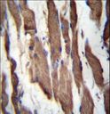 TGFBRAP1 / TRAP-1 Antibody - TGFBRAP1 Antibody immunohistochemistry of formalin-fixed and paraffin-embedded human skeletal muscle followed by peroxidase-conjugated secondary antibody and DAB staining.
