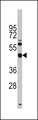 TGIF1 Antibody - Western blot of anti-TGIF1 Antibody (Center L223) (RB14109) in Y79 cell line lysates (35 ug/lane). TGIF1(arrow) was detected using the purified antibody.
