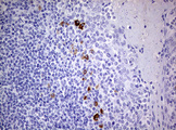 TGIF1 Antibody - IHC of paraffin-embedded Human tonsil using anti-TGIF1 mouse monoclonal antibody. (Heat-induced epitope retrieval by 10mM citric buffer, pH6.0, 120°C for 3min).