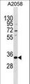 TGIF2LX Antibody - TGIF2LX Antibody western blot of A2058 cell line lysates (35 ug/lane). The TGIF2LX antibody detected the TGIF2LX protein (arrow).