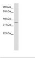 Tgif2lx1 Antibody - Testis Lysate.  This image was taken for the unconjugated form of this product. Other forms have not been tested.