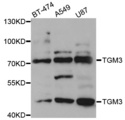 TGM3 / Transglutaminase 3 Antibody - Western blot analysis of extracts of various cell lines.
