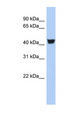 TH / Tyrosine Hydroxylase Antibody - TH / Tyrosine Hydroxylase antibody Western blot of Fetal Stomach lysate. This image was taken for the unconjugated form of this product. Other forms have not been tested.