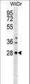 THAP10 Antibody - THAP10 Antibody western blot of WiDr cell line lysates (35 ug/lane). The THAP10 Antibody detected the THAP10 protein (arrow).