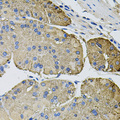 THBS2 / Thrombospondin 2 Antibody - Immunohistochemistry of paraffin-embedded human stomach tissue.