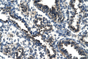 THG-1 / TSC22D4 Antibody - TSC22D4 antibody ARP30107_T100-NP_112197-TSC22D4 (TSC22 domain family, member 4) Antibody IHC of formalin-fixed, paraffin-embedded human Lung. Positive label: Alveolar cells indicated with arrows. Antibody concentration 4-8 ug/ml. Magnification 400X.  This image was taken for the unconjugated form of this product. Other forms have not been tested.