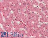 THNSL2 Antibody - Human Liver: Formalin-Fixed, Paraffin-Embedded (FFPE).  This image was taken for the unconjugated form of this product. Other forms have not been tested.