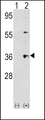 THPO / TPO / Thrombopoietin Antibody - Western blot of THPO (arrow) using rabbit polyclonal THPO Antibody. 293 cell lysates (2 ug/lane) either nontransfected (Lane 1) or transiently transfected with the THPO gene (Lane 2) (Origene Technologies).