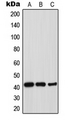 THPO / TPO / Thrombopoietin Antibody - Western blot analysis of Thrombopoietin expression in HepG2 (A); mouse liver (B); rat liver (C) whole cell lysates.