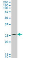 THTPA Antibody - THTPA monoclonal antibody (M01), clone 3F6 Western blot of THTPA expression in A-431.