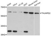 THUMPD2 Antibody - Western blot analysis of extracts of various cell lines, using THUMPD2 Antibody at 1:3000 dilution. The secondary antibody used was an HRP Goat Anti-Rabbit IgG (H+L) at 1:10000 dilution. Lysates were loaded 25ug per lane and 3% nonfat dry milk in TBST was used for blocking. An ECL Kit was used for detection and the exposure time was 10s.