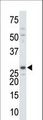 Thymidylate Kinase Antibody - The anti-DTYMK antibody is used in Western blot to detect DTYMK in mouse colon tissue lysate.