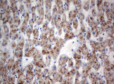 TIA-1 Antibody - IHC of paraffin-embedded Human liver tissue using anti-TIA1 mouse monoclonal antibody. (Heat-induced epitope retrieval by 10mM citric buffer, pH6.0, 120°C for 3min).