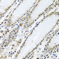 TIA-1 Antibody - Immunohistochemistry of paraffin-embedded human stomach using TIA1 antibody at dilution of 1:100 (40x lens).