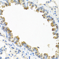 TICAM1 / TRIF Antibody - Immunohistochemistry of paraffin-embedded mouse lung tissue.