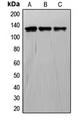 TIE1 / TIE Antibody - Western blot analysis of TIE1 expression in A549 (A); ECV304 (B); NIH3T3 (C) whole cell lysates.