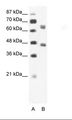 TIF-IA / RRN3 Antibody - A: Marker, B: Jurkat Cell Lysate.  This image was taken for the unconjugated form of this product. Other forms have not been tested.