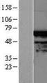 TIGD4 Protein - Western validation with an anti-DDK antibody * L: Control HEK293 lysate R: Over-expression lysate