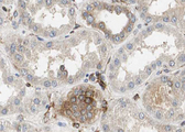 TIM23 Antibody - 1:100 staining mouse kidney tissue by IHC-P. The sample was formaldehyde fixed and a heat mediated antigen retrieval step in citrate buffer was performed. The sample was then blocked and incubated with the antibody for 1.5 hours at 22°C. An HRP conjugated goat anti-rabbit antibody was used as the secondary.