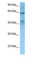 TIMD4 / TIM4 / TIM-4 Antibody - TIMD4 / TIM4 / TIM-4 antibody Western Blot of 293T.  This image was taken for the unconjugated form of this product. Other forms have not been tested.