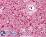 TIMELESS Antibody - Anti-TIMELESS antibody IHC of human thymus. Immunohistochemistry of formalin-fixed, paraffin-embedded tissue after heat-induced antigen retrieval. Antibody concentration 5 ug/ml.  This image was taken for the unconjugated form of this product. Other forms have not been tested.