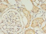 TIMM10 Antibody - Immunohistochemistry of paraffin-embedded human kidney using antibody at 1:100 dilution.  This image was taken for the unconjugated form of this product. Other forms have not been tested.