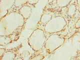 TIMM10B / FXC1 Antibody - Immunohistochemistry of paraffin-embedded human thyroid tissue at dilution of 1:100
