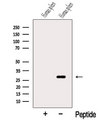 TIMM21 Antibody - Western blot analysis of extracts of human spleen tissue using C18orf55 antibody. The lane on the left was treated with blocking peptide.