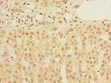 TIMM9 Antibody - Immunohistochemistry of paraffin-embedded human adrenal gland tissue using antibody at dilution of 1:100.