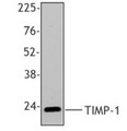 TIMP1 Antibody - Western blot of recombinant human TIMP-1 protein using anti-TIMP-1, clone F31P2A5.