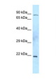 TIMP2 Antibody - TIMP2 antibody Western blot of Mouse Thymus lysate. Antibody concentration 1 ug/ml.  This image was taken for the unconjugated form of this product. Other forms have not been tested.