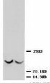 TIMP3 Antibody -  This image was taken for the unconjugated form of this product. Other forms have not been tested.
