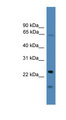 TIMP4 Antibody - TIMP4 antibody Western blot of THP-1 cell lysate. This image was taken for the unconjugated form of this product. Other forms have not been tested.