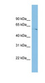 TINAGL1 / Lipocalin 7 Antibody - TINAGL1 antibody Western blot of ACHN lysate. This image was taken for the unconjugated form of this product. Other forms have not been tested.
