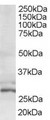 TIP30 / HTATIP2 Antibody - Goat Anti-TIP30 / CC3 Antibody (0.6µg/ml) staining of HeLa lysate (35µg protein in RIPA buffer). Primary incubation was 1 hour. Detected by chemiluminescencence.