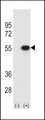 TIP48 / RUVBL2 Antibody - Western blot of RUVBL2 (arrow) using rabbit polyclonal RUVBL2 Antibody. 293 cell lysates (2 ug/lane) either nontransfected (Lane 1) or transiently transfected (Lane 2) with the RUVBL2 gene.