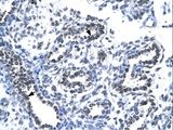 TIP48 / RUVBL2 Antibody - RUVBL2 antibody ARP32378_T100-NP_006657-RUVBL2 (RuvB-like 2 (E. coli)) Antibody was used in IHC to stain formalin-fixed, paraffin-embedded human lung.  This image was taken for the unconjugated form of this product. Other forms have not been tested.