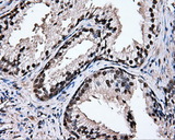 TIPRL / TIP Antibody - Immunohistochemical staining of paraffin-embedded prostate tissue using anti-TIPRL mouse monoclonal antibody. (Dilution 1:50).