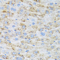 TIRAP Antibody - Immunohistochemistry of paraffin-embedded mouse liver using TIRAP antibody at dilution of 1:100 (40x lens).