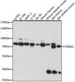TIRC7 / TCIRG1 Antibody - Western blot analysis of extracts of various cell lines, using TCIRG1 antibody at 1:1000 dilution. The secondary antibody used was an HRP Goat Anti-Rabbit IgG (H+L) at 1:10000 dilution. Lysates were loaded 25ug per lane and 3% nonfat dry milk in TBST was used for blocking. An ECL Kit was used for detection and the exposure time was 30s.