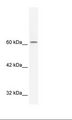 TLE3 Antibody - HepG2 Cell Lysate.  This image was taken for the unconjugated form of this product. Other forms have not been tested.