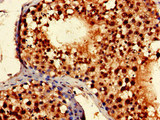 TLK2 Antibody - Immunohistochemistry of paraffin-embedded human testis tissue at dilution of 1:100