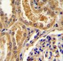 TLL2 Antibody - TLL2 Antibody immunohistochemistry of formalin-fixed and paraffin-embedded human kidney tissue followed by peroxidase-conjugated secondary antibody and DAB staining.