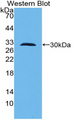 TLR10 Antibody - Western blot of recombinant TLR10.