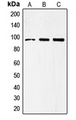 TLR4 Antibody - Western blot analysis of CD284 expression in COLO205 (A); PC3 (B); HepG2 (C) whole cell lysates.