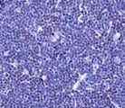 TLR4 Antibody - Immunohistochemistry: TLR4 Antibody - Analysis of TLR4 in mouse spleen using DAB with hematoxylin counterstain.  This image was taken for the unconjugated form of this product. Other forms have not been tested.