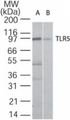TLR5 Antibody - Western blot of TLR5 in A) Ramos and B) Raw cell lysate using antibody at 2 ug/ml.